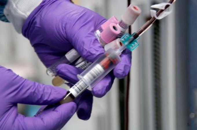 Blood test