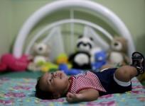 Zika virus