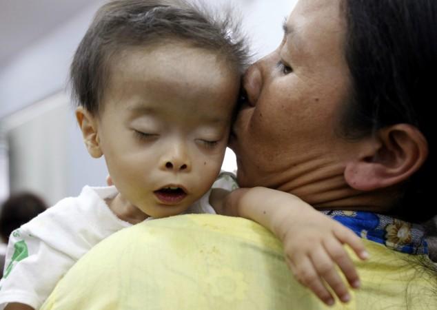 children heart diseases