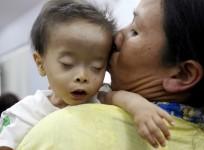 children heart diseases