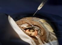 eye injection