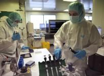 Researchers develop a new sensitive test to detect antibodies for Cancer, HIV