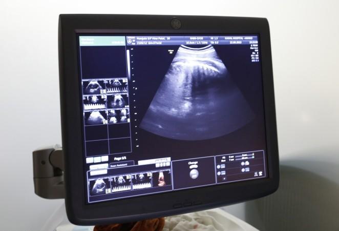 IVF CEntre