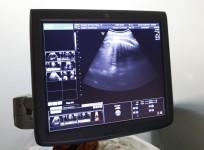 IVF CEntre