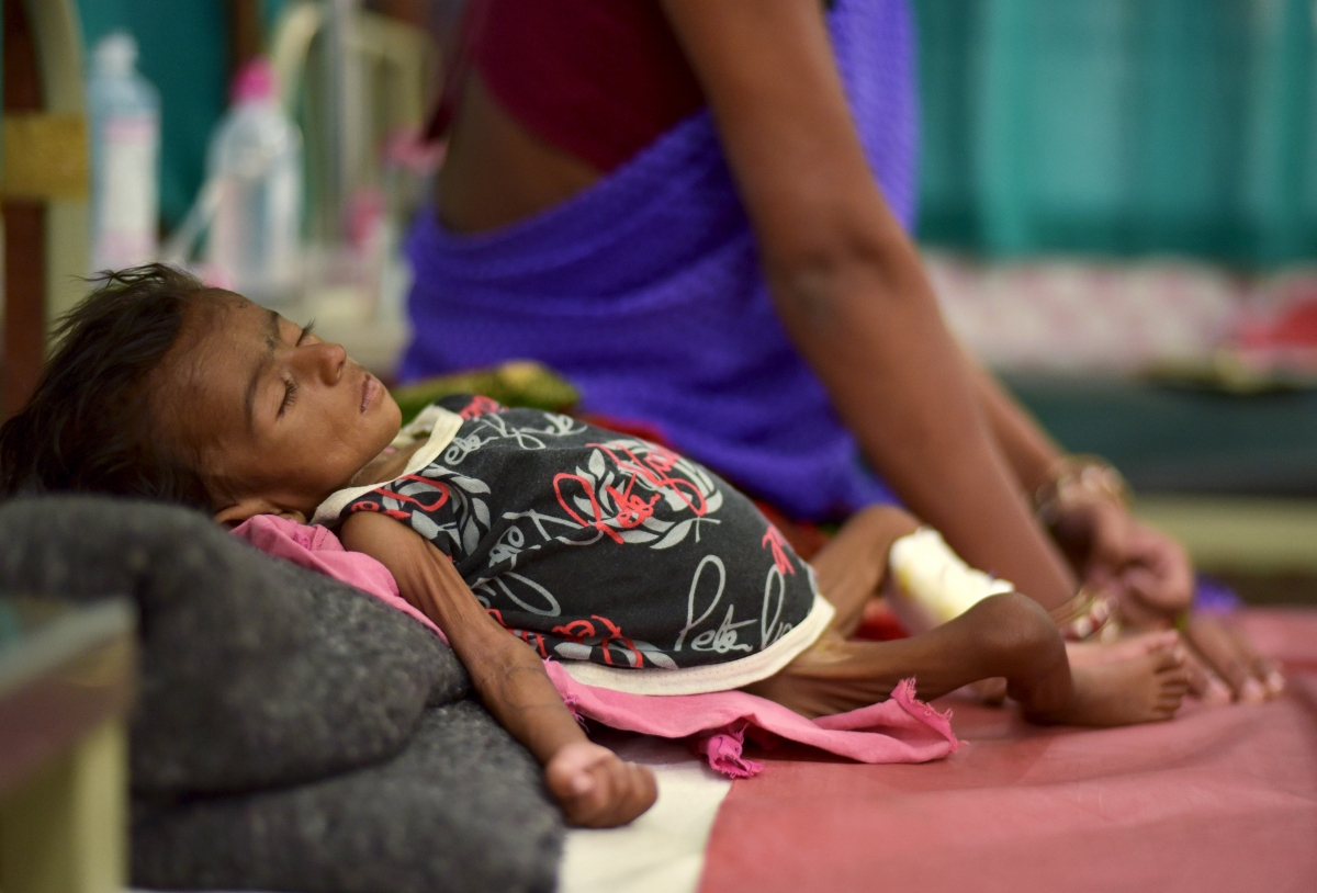 India home to largest number of stunted children in world ...