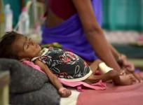 malnutrition