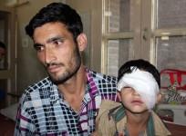 Pellet injuries
