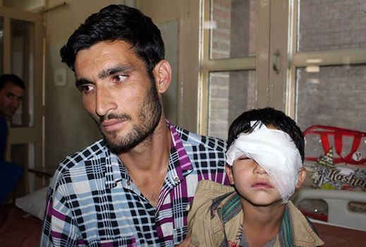 Pellet injuries