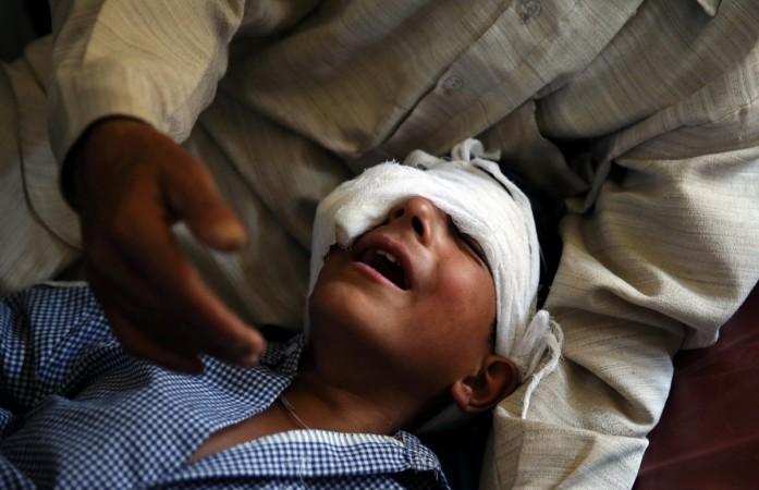 Kashmir pellet child