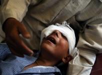 Kashmir pellet child