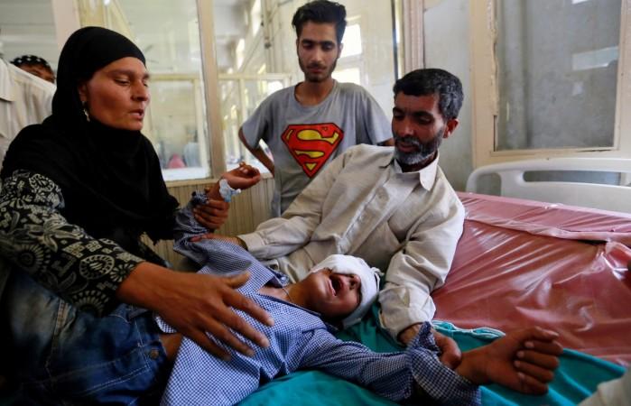 pellet guns Kashmir