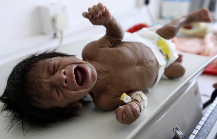 File picture used for illustration purpose only. children yemen