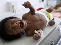 children-yemen