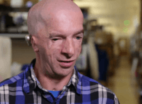 New research gives hope to those with head and facial deformities