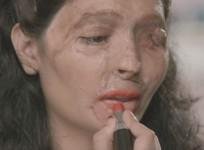 How Indias acid attack victims are empowering themselves