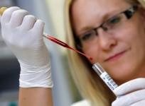 blood test