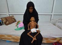 Malnutrition