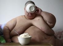 World's most obese man