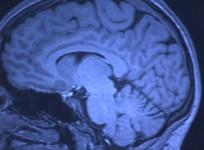 The religious brain reacts to God like a drug