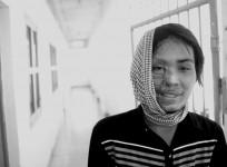 acid attack, acid attack survivor,