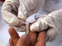 HIV/AIDS