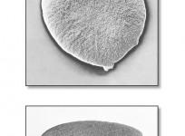 Gonorrhea, sexually transmitted disease, health,