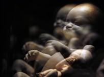 Female foeticide