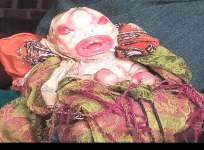 alien, baby, girl, Bihar, mother, India, scary, breastfeeding, premature,