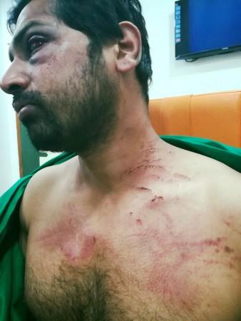 Dr. Rohan Mamunkar beaten up