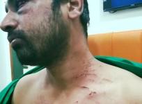 Dr. Rohan Mamunkar beaten up