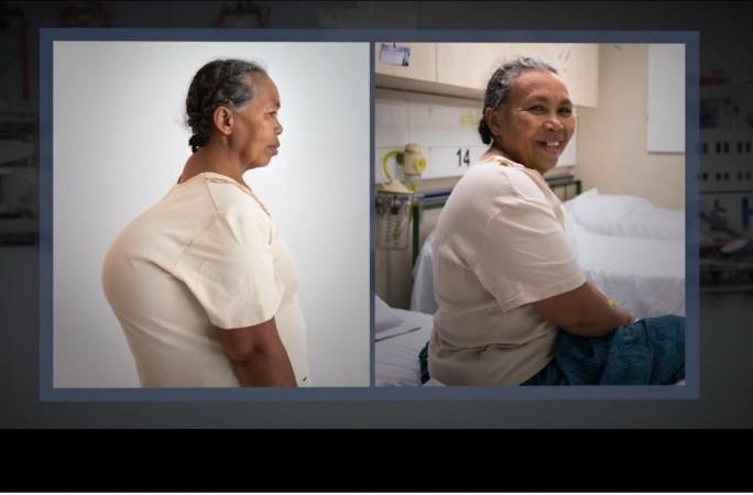 Mariette was relieved after the tumor was operated and removed. tumor, Madagascar, woman, Mercy Ships, health,