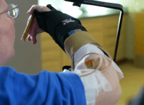 Quadriplegic moves his arm for the first time in eight years thanks to novel neuro-prosthesis