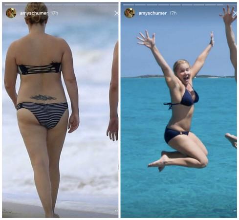 Amy Schumer Hits Back at Bikini Bashers: 'Doesn't Everyone Wear the Same  Bathing Suit for Like 4 Years