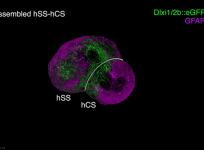 Human brain circuits grown in a dish for the first time