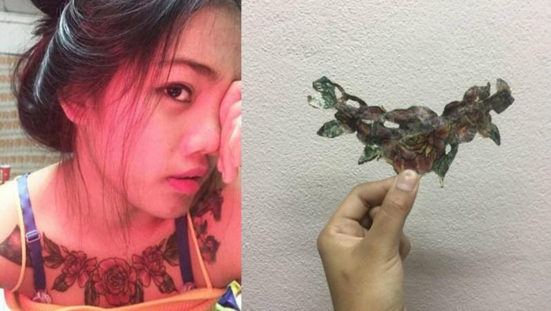 Thailand girl Pasuda Reaw's tattoo removal fiasco is a lesson for everyone. Tattoo, Tattoo removal fiasco