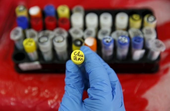 zika virus, Aedes, health, prevention,