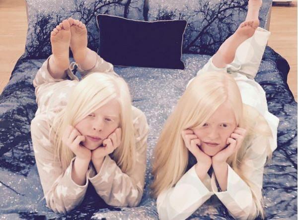 best friends Lucy and Sammy with albinism kick up a stylish storm on Instagram Lucy and Sammy