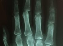 othopedic, health, bones,