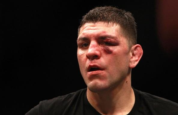 Nick Diaz. Nick Diaz, Nick Diaz suspension, Nick Diaz anti-doping violation, UFC, USADA