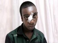 rare surgery, rare condition, encephlocele , tribal boy, kerela,