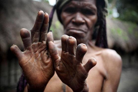 Dani tribe, bizarre practices, weird,