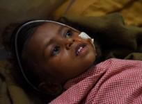 Encephalitis