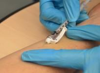 injections