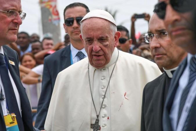 Pope Francis was left with blood on his cape in Colombia Pope Francis