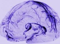 brain, lymphatic vessels,