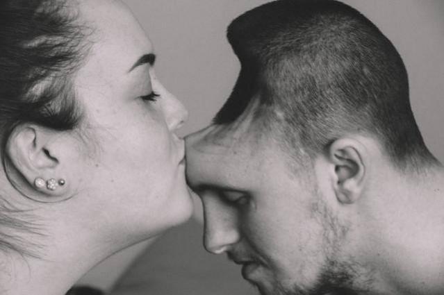 Brianna and Austin Hole in the skull