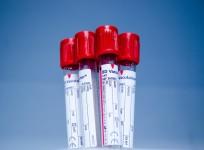 blood type, blood groups, health,