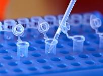 DNA sample