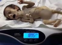Heartbreaking footage shows extent of child malnutrition in conflict-ridden Syria