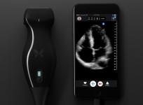 Butterfly iQ ultrasound machine and iPhone